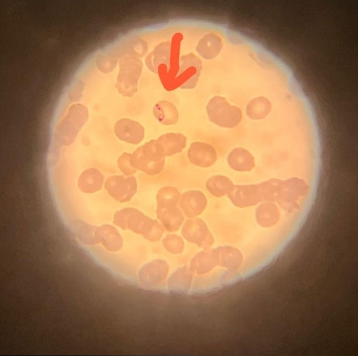 Blutprobe eines Hundes mit Babesien unter dem Mikroskop
